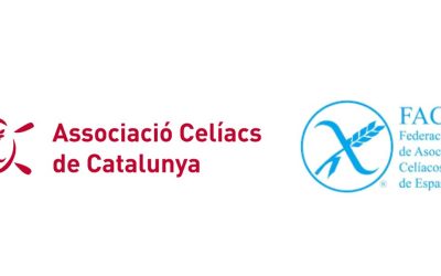 “El canvi en la norma del pa encareix el pa sense gluten”